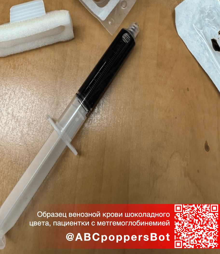 Если принять попперс внутрь в Новоалтайске это вызывает метгемоглобинемию. Смертельное состояние Если принять попперс внутрь в Новоалтайске это вызывает метгемоглобинемию. Смертельное состояние